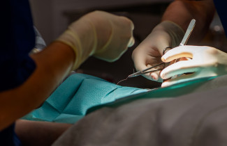 Haavanompelu leikkauksessa.