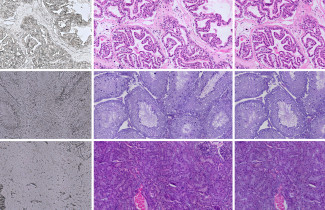Vasemmalla värjäämätön kudos, keskellä kemiallisesti värjätty ja oikealla virtuaalivärjätty kudos. Ylärivillä eturauhanen, keskellä kives ja alhaalla munuainen. Kuva: Sonja Koivukoski.