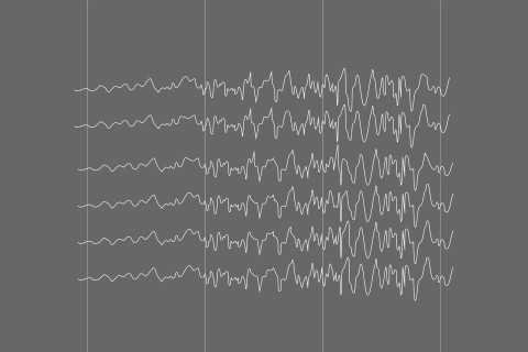 EEG pattern during epileptic seizure