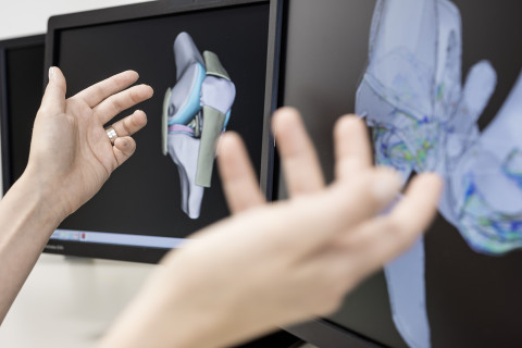 Knee joint image on computer screen