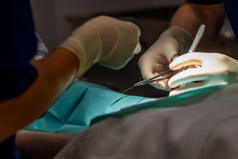 Haavanompelu leikkauksessa.