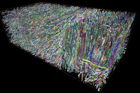 Myeliinin peittämiä aksoneita aivojen valkoisessa aineessa. Tehty elektronimikroskooppikuvasta tekoälyn avulla. Ali Abdollahzadeh.