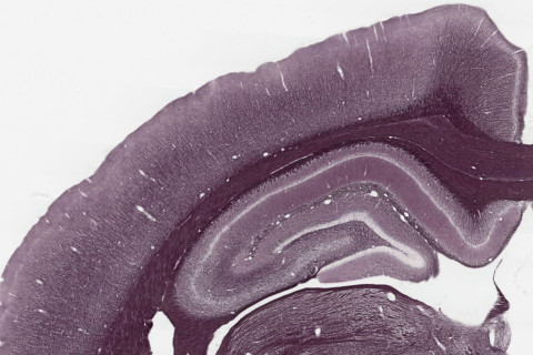 Myelin structures in the brain.