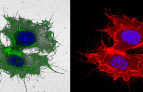 Pictures of cancer cells