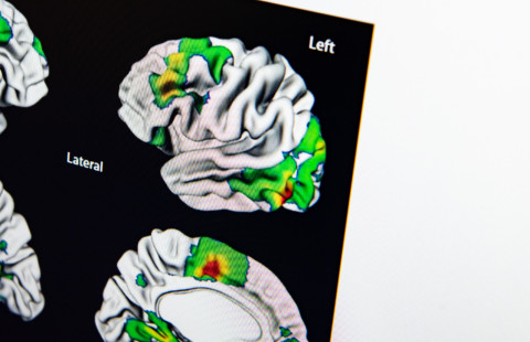Elderly patient performing a drawing test.