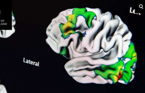 Aivojen magneettikuva.