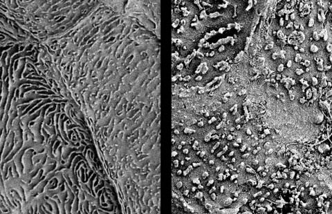 Suun limakalvon pintasolukkoa.