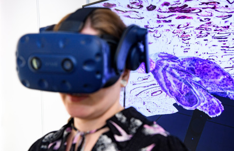 Nainen tutkii kolmeulotteista kasvaimen virtuaalimallia.