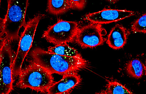 Melanoma cells with the cell membrane protein CD44 stained in red and the nucleus in blue. Dil-labelled extracellular vesicles taken up by cancer cells are shown in green. Image by Kaisa Mäki-Mantila.